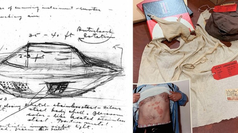 Sự kiện UFO hồ Falcon: Người đàn ông bị bỏng sau khi chạm vào UFO và dấu vết trên cơ thể không mờ đi suốt 32 năm!