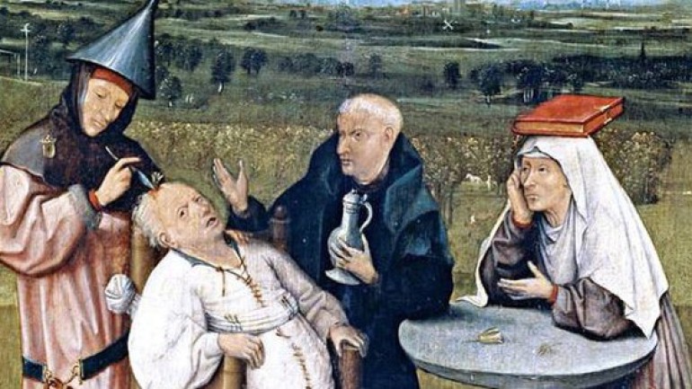 Trepanation: Thủ tục phẫu thuật sọ lâu đời nhất thế giới vẫn tồn tại đến ngày nay!