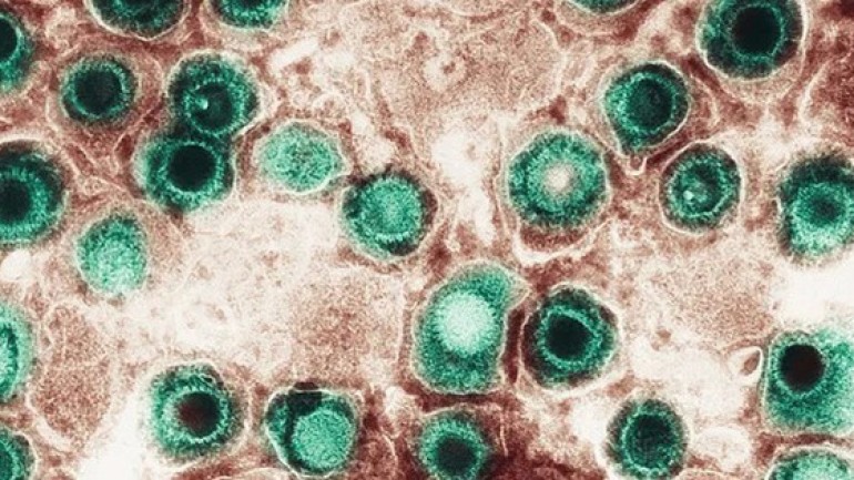 Virus herpes 'tái sinh' ẩn nấp trong não có thể liên quan đến chấn động và sa sút trí tuệ